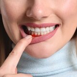 Okto Dent - Clinica stomatologica Buftea
